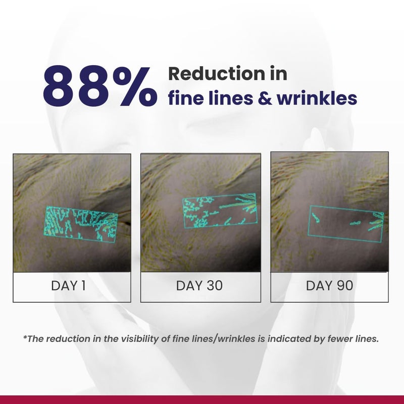 RE' EQUIL 0.1% Retinol Night Cream | Repairs Wrinkles & Fine Lines | Improves Skin Firmness | Beginner Friendly | All Skin Types | 30G - Image 5