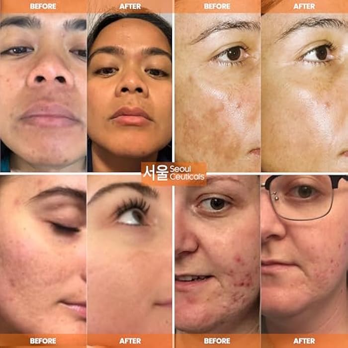 SeoulCeuticals Korean Skin Care 20% Vitamin C Hyaluronic Acid Serum + CE Ferulic Acid - Potent Anti Aging, Anti Wrinkle Korean Beauty 1oz - Image 3