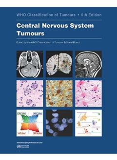 Central Nervous System Tumours  - Image 5