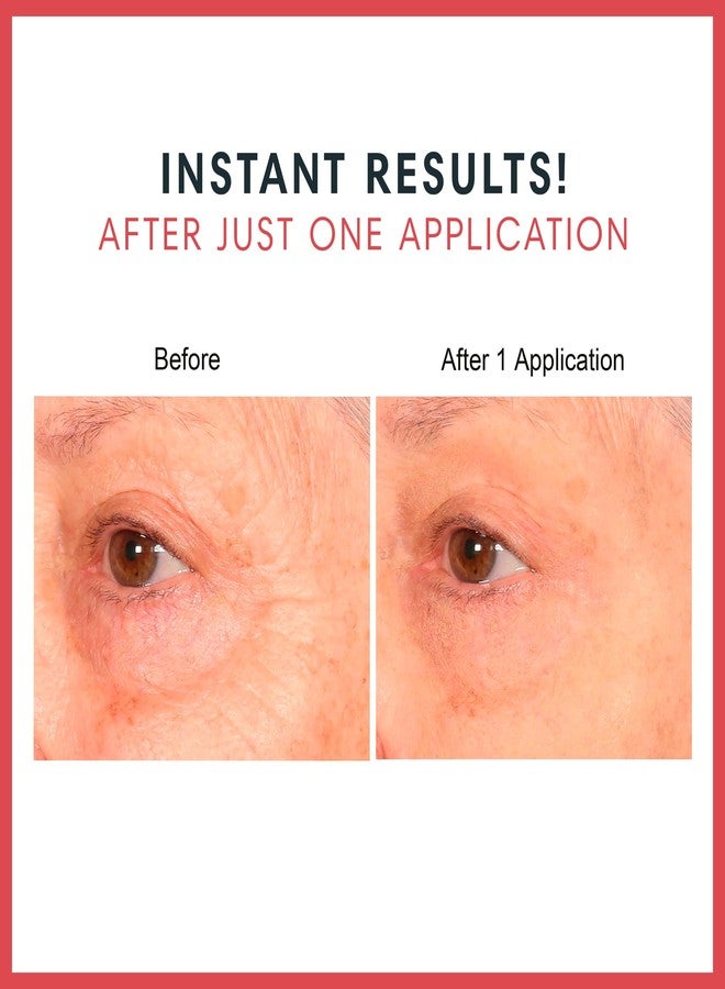 Consult Beaute استشارة بيوتي جل العين الفوري الملون - لتقليل الانتفاخ تحت العينين - رفع مؤقت للجفن - مضيء - لتعزيز إنتاج الكولاجين والإيلاستين - للنساء والرجال - 0.5 أونصة سائلة - Image 3