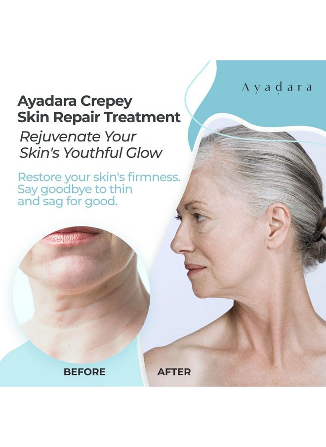 AYADARA - Crepey Skin Repair Treatment 8Oz, Firming Lotion For Loose Skin, Crepe Corrector Collagen Cream For Body Skin-Tightening, Wrinkle Cream For Face, Neck, Arms And Legs, 500+ Uses - Image 1
