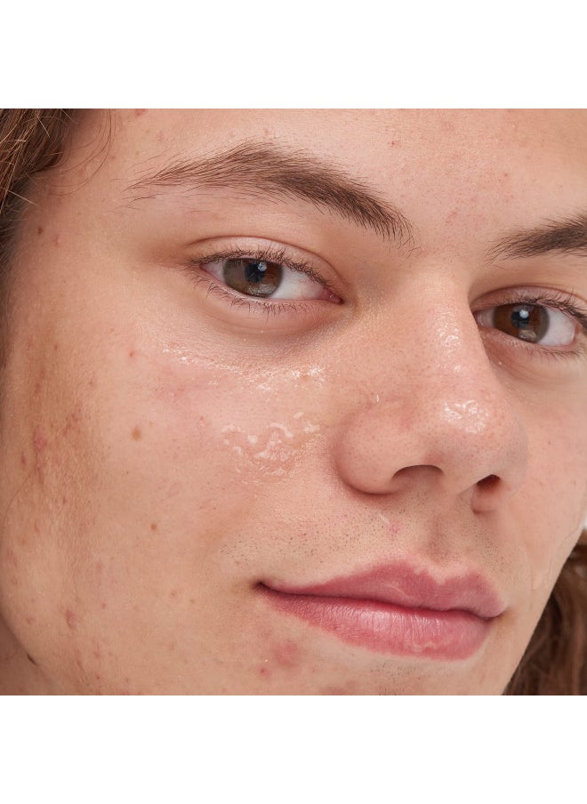 The Inkey List - Beta Hydroxy Acid (BHA) Serum - Image 1