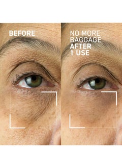 Dr. Brandt Skincare Dr. Brandt Needles No More Baggage Eye De-Puffing Gel Tube 15 g / 0.5 oz  - Image 2