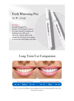GlorySmile Wireless Rechargeable Teeth Whitening Light Kit Black Luxury Home Tooth Cleaning Set Stain & Plaque Removal With Max Effect Unisex  - Image 5