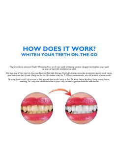 GlorySmile Wireless Rechargeable Teeth Whitening Light Kit Black Luxury Home Tooth Cleaning Set Stain & Plaque Removal With Max Effect Unisex  - Image 4