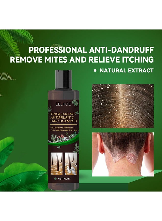EELHOE Tinea Capitis Antipruritic Hair Shampoo, Safe Gentle Effective Anti-Dandruff Remove Mites and Relieve Itching Natural Extract Prevents Hair Loss 100ml - Image 4