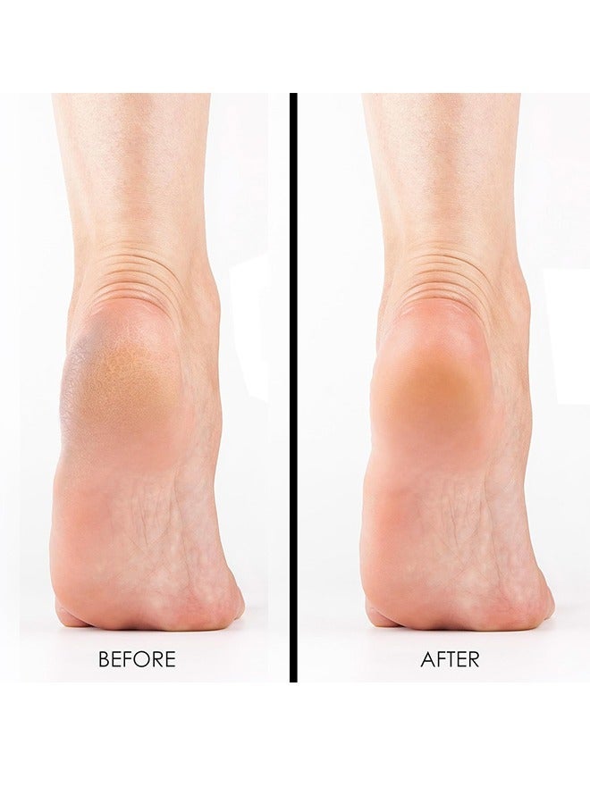 لوف بوميس لونين الحجر الظهير رغوة الزجاج القدم فرك الجلد الميت ملف إزالة الكالوس تقشير القدم فرك القدم إصلاح القدم الزجاج الحجر الظهير للأقدام ، مزيل الكالوس وفرك القدم و أداة تقشير العلاج بالأقدام - Image 4