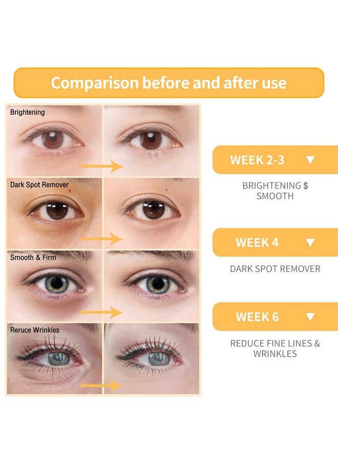 Breylee سيروم فيتامين سي للوجه والعين (O6 أونصة) لتفتيح البشرة وإزالة البقع الداكنة وتقليل التجاعيد ومكافحة الشيخوخة مرطب سيروم تفتيح مع حمض الهيالورونيك وفيتامين E وريتنويد ونيكوتيناميد - Image 3