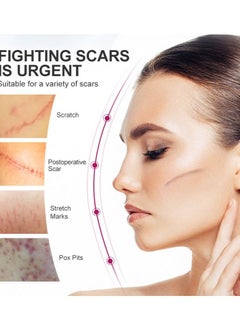 آر توب آر كريم إصلاح الندبات جل إزالة علامات التمدد  - Image 2