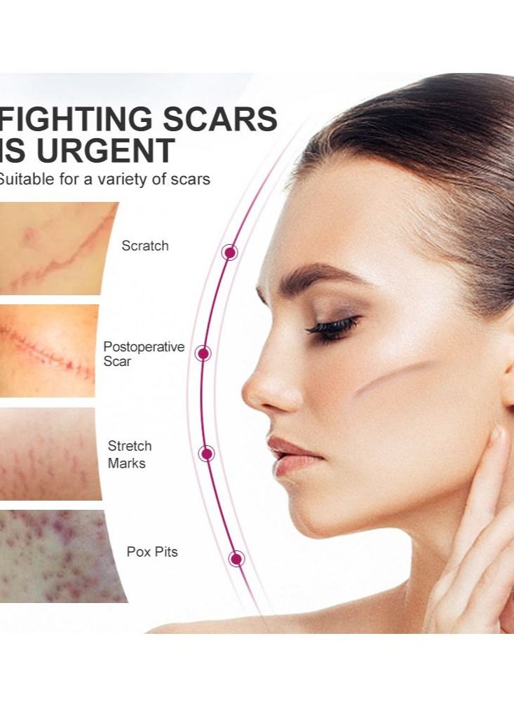 آر توب آر كريم إصلاح الندبات جل إزالة علامات التمدد  - Image 2