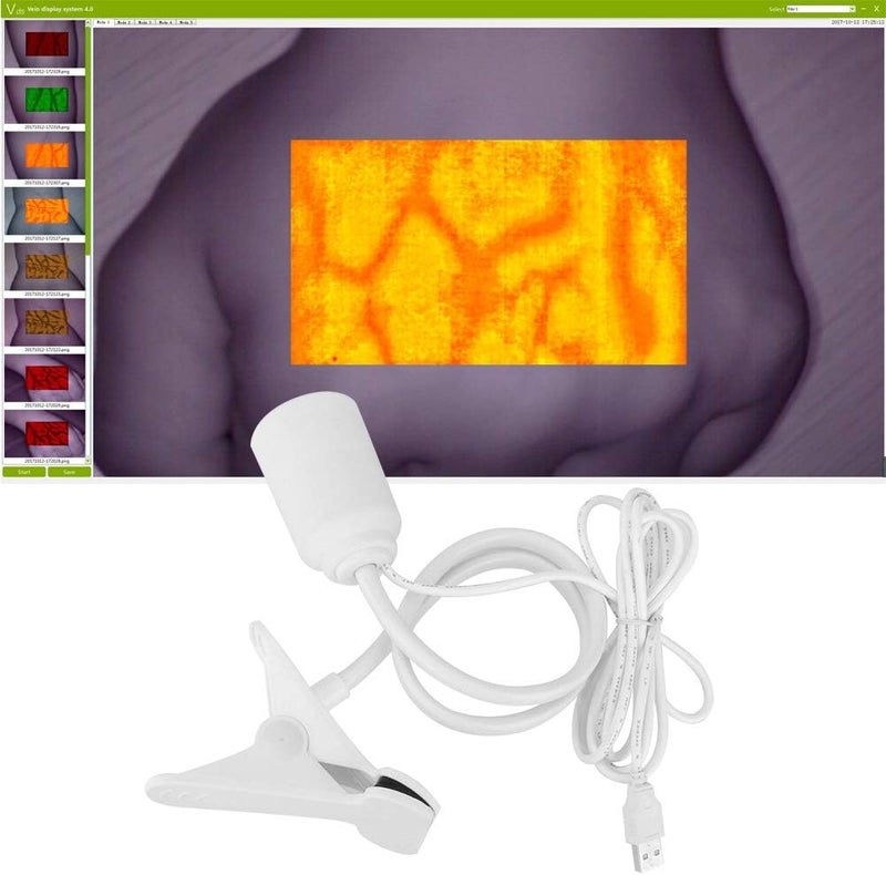 klarako Vein Finder, Led Vein Display Vein Finder, Lights Imaging Vein Finder for Adult Baby, Vein Viewer Transilluminator, Vein Display Instrument - Image 1