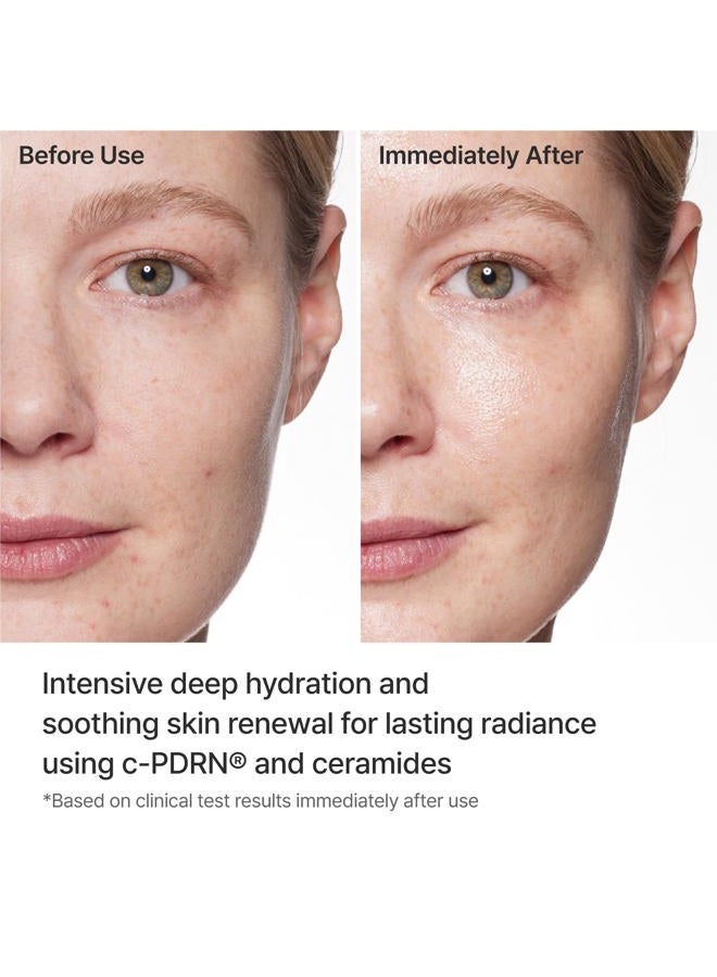 REJURAN ® Turnover Mask, c-PDRN® (5ea) – Original Salmon DNA for Firming, Hydration, Repairing & Revitalizing. Achieve Youthful, Radiant Skin. Korean Skincare. Ultra Microfiber Sheet Mask - Image 4