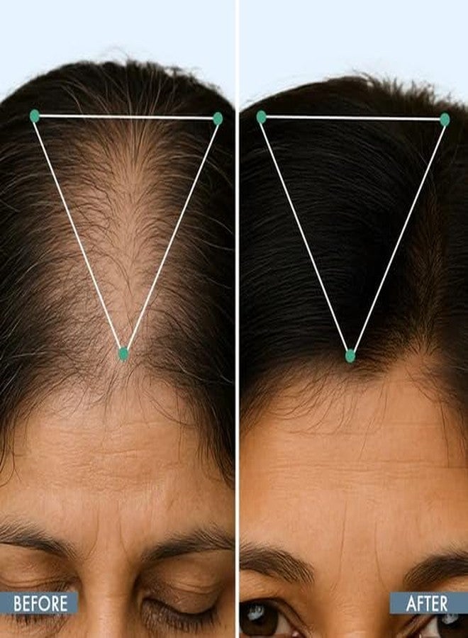 ThriveCo Women’s Balance Hair Supplement | For Stronger, thicker Hair | 100% Drug-Free, Multi vitamin Capsules | 30 Capsules - Image 5