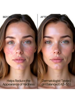 BodyJ4You BodyJ4You Hypochlorous Acid Spray for Face Cleaner - HOCL Facial Toner Acne Sensitive Skin - HOCL Molecule Spray Topical Skin Redness Relief Breakouts - Piercing Aftercare Fine Mist - Pack of 2  - Image 2