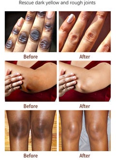 MOOYAM Dark Knuckles Remover From Hand,Dark Spot Correcting Glow Serum,Lightweight Body Oil,Whitening Serum For Hyperpigmentation,Dark Spot Remover For Hand&Foot&Body,Brightening Body Oil For Darkness  - Image 3