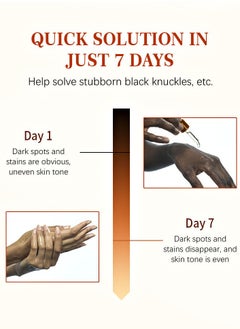 MOOYAM Dark Knuckles Remover From Hand,Dark Spot Correcting Glow Serum,Lightweight Body Oil,Whitening Serum For Hyperpigmentation,Dark Spot Remover For Hand&Foot&Body,Brightening Body Oil For Darkness  - Image 4