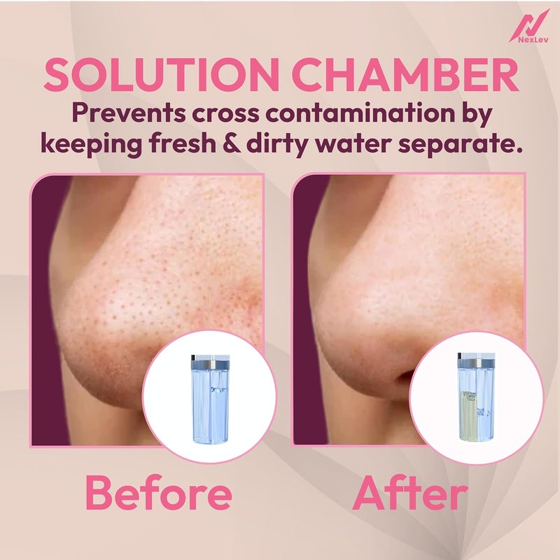 nexlev جهاز نيكسلڤ لإزالة الرؤوس السوداء والرؤوس البيضاء | قابل لإعادة الشحن | 60 دقيقة استخدام | منظف مسام حب الشباب والبثور | 6 رؤوس | آلة شفط ديرما الكهربائية | جهاز تنظيف الوجه الهيدرا | للرجال والنساء | BR-01 - Image 4