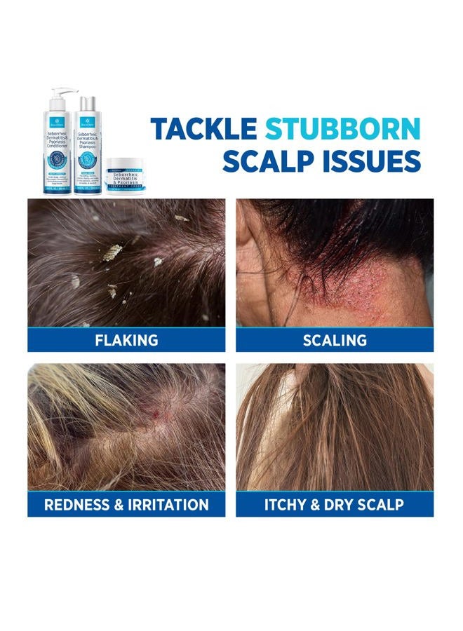 Roycederm Seborrheic Dermatitis & Psoriasis Cream, Shampoo and Conditioner Set - Scalp Therapy System for Folliculitis, Psoriasis, Dandruff, Dry Scalp - Scalp Treatment to Relieve Itching, Flaking, Irritation - Image 5