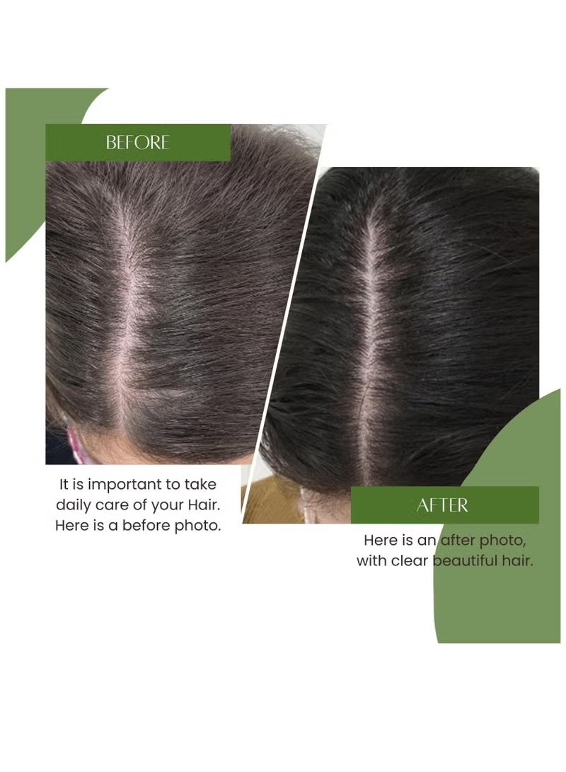 OGAILI Sidr Al Yeman Powder Natural Herbal Hair Cleanser Rejuvenates Hair follicle Stimulate Hair Growth Fights Fungus & Scalp Bacteria Control Hair Fall & Reduce Dandruff 180Ge - Image 3