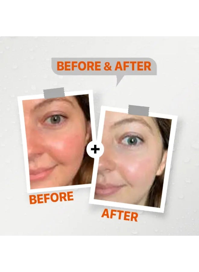 سي-ليت صن سكرين لوشن +50 SPF – حماية فائقة من الشمس لجميع أنواع البشرة – 50 جم
