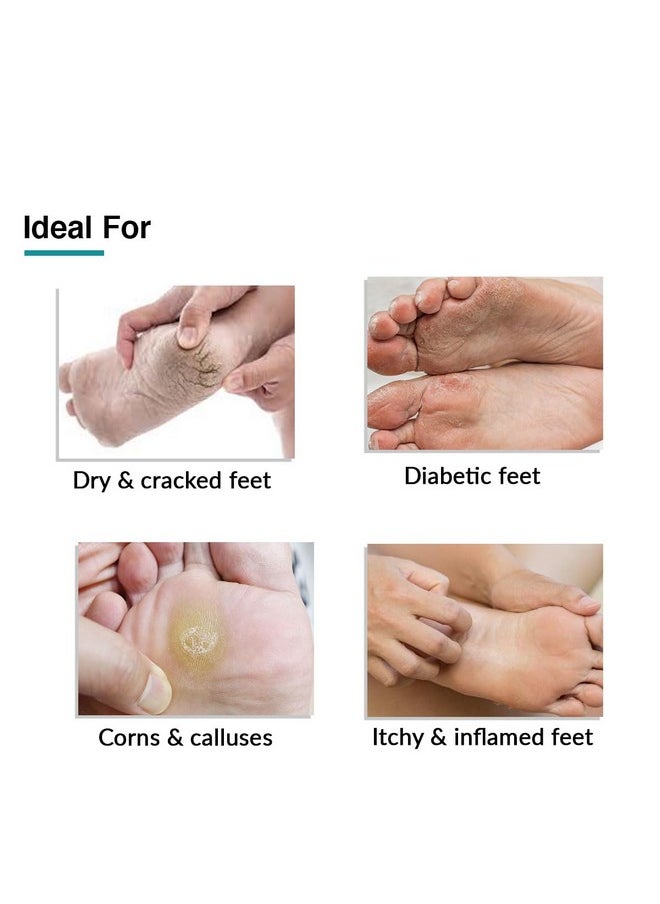 FIXDERMA Foobetik Cream, Foot Cream, Foot Care For Diabetic, For Dry & Cracked Feet, Moisturizes & Soothes Feet, Heel Repair, For Calloused, Or Chapped Skin, Paraben Free - 50G  - Image 3