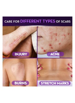 Cicatricure Advanced Scar for Surgical Scars, Stretch Marks and Burns 28 g - pzsku/ZADE8EC490E67EA2B6FB2Z/45/_/1740061154/518f09eb-8e5e-4d36-8c5a-9ddfc1ea8bf6