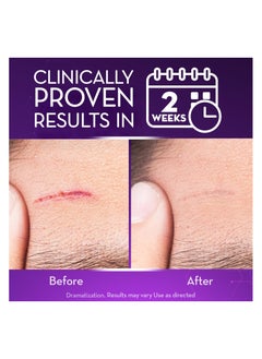 Cicatricure Advanced Scar for Surgical Scars, Stretch Marks and Burns 28 g - pzsku/ZADE8EC490E67EA2B6FB2Z/45/_/1740061154/d6a194c1-a804-42c1-965c-d4aa6c68bd76