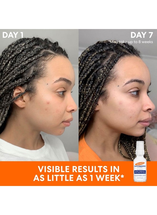 PALMER'S - Palmer's Skin Success Extra Strength 10% Tone Correcting Bundle (Cream + Serum) - Image 1