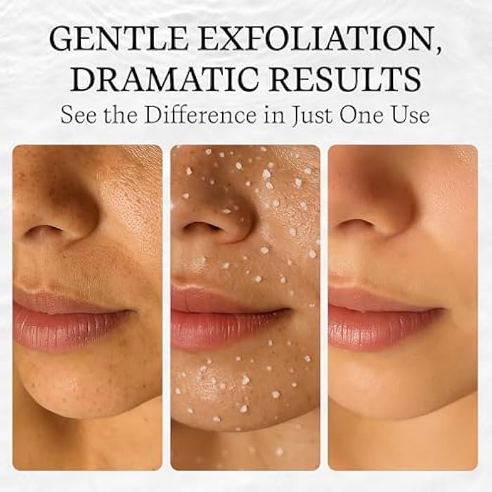 Vivo Per Lei Facial Peeling Gel - Contains Dead Sea Minerals and Nut Shell Powder - Gentle Face Exfoliator Scrub and Blackhead Remover - Peel Your Skin to a Fresher You - 4.05 Fl oz. - Image 2