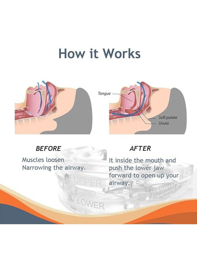 general Adjustable Braces Tray Night Anti-Grinding Braces with Storage Box Color Box, Adjustable Anti-Snoring Mouthguards for Men and Women to Improve Sleep - Image 3