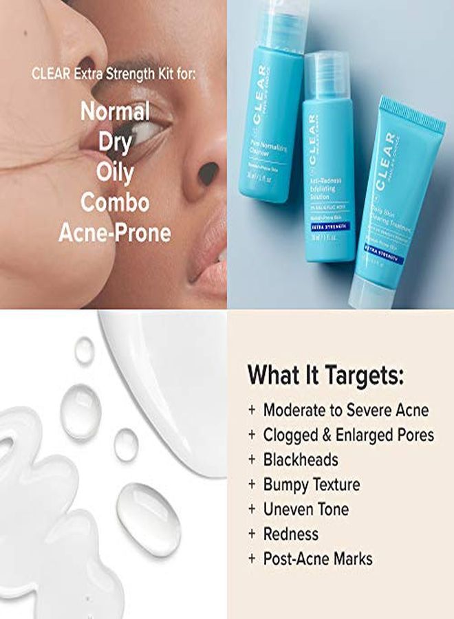 PAULA'S CHOICE مجموعة السفر لعلاج حب الشباب بتركيز إضافي 2% حمض الساليسيليك و 5% بيروكسايد البنزيل لتخفيف احمرار حب الشباب الشديد حجم تجريبي لمدة أسبوعين - Image 5