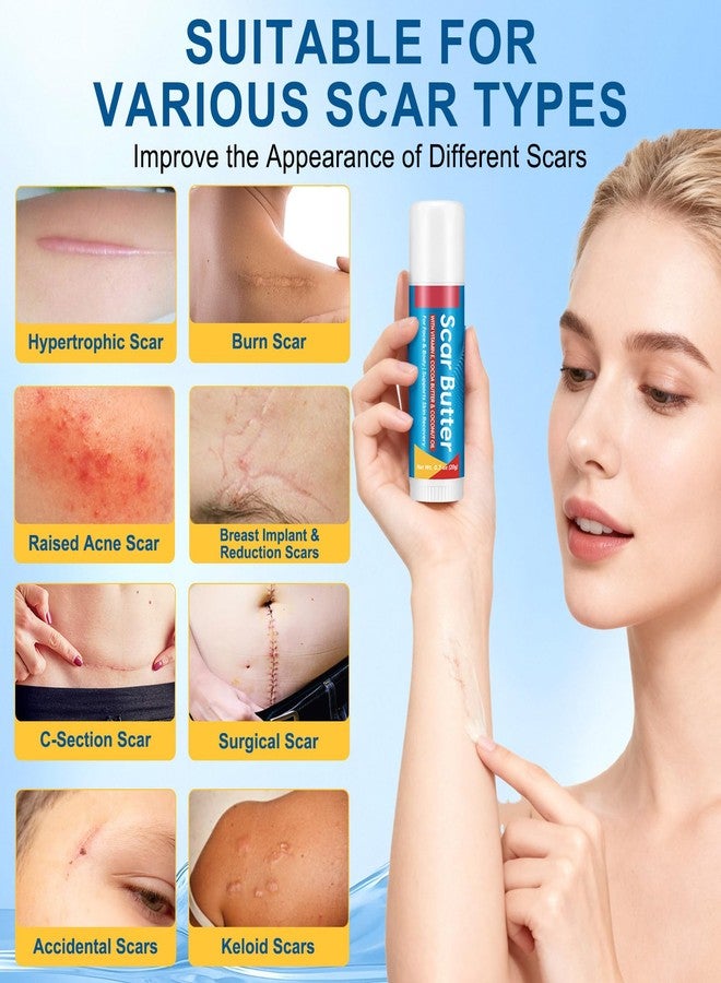 Scar Butter Stick with Vitamin E, Cocoa Butter & Coconut Oil - Intensive Moisturizing Skin Care for Face & Body | Hydrates & Softens Dry Skin | Improves Appearance of Scar-Prone Skin | 1 Pack - Image 2