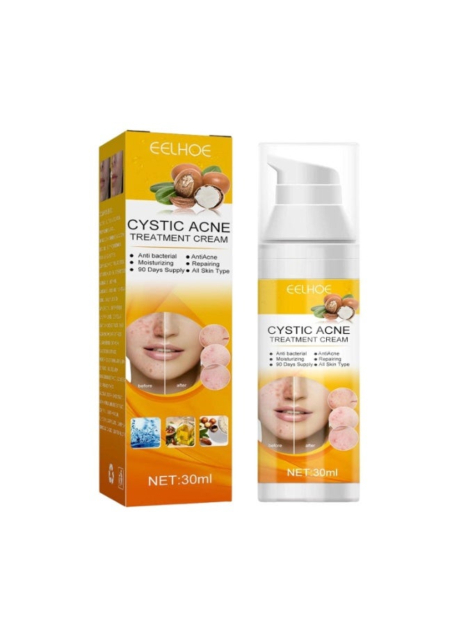 EELHOE Cystic Acne Treatment Cream – Fast Spot Removal, Anti-Bacterial Repair & Deep Moisturizing Formula for All Skin Types - Image 1