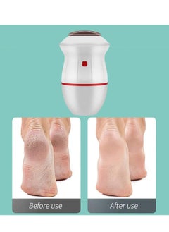 SYOSI Electric Callus Remover Vacuum Adsorption Foot Grinder Usb Pedicure Care Tools Absorbing Dual-Speed For Dead Hard Cracked Dry Skin  - Image 3