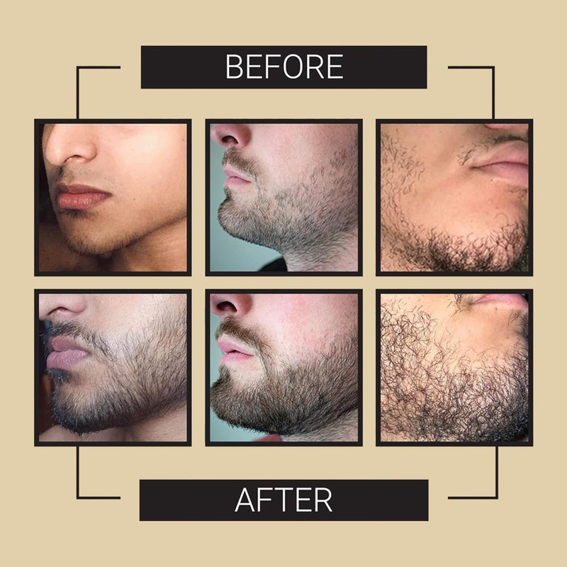 Crafted Beards Beard Growth Oil Serum - 1 fl Oz - Unscented - Helps Grow A Thicker Beard, Improves Beard Health, Fills in Thin and Patchy Spots - (1 Pack) - Image 2