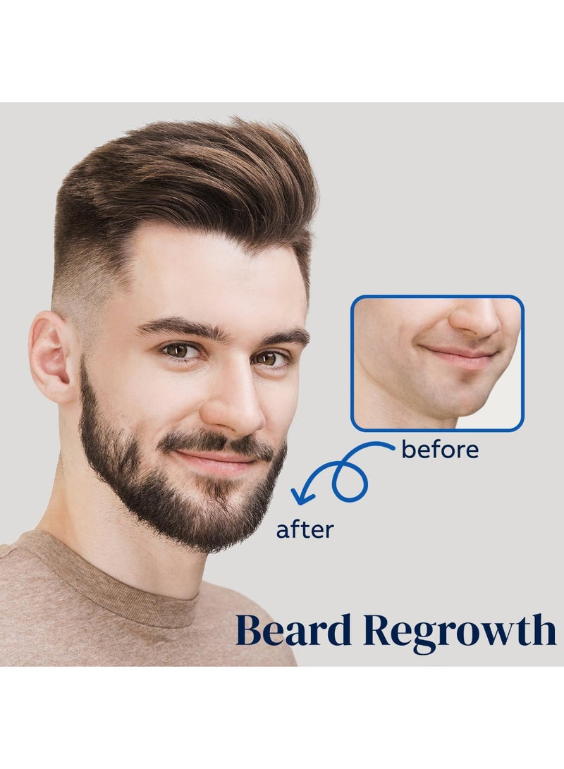 5% Minoxidil for Men Beard and Hair, Minoxidil for Women Hair Growth Spray with Biotin & Castor Oil, Strengthens Weak Roots, Repairs Thinning Hair Spray (60ml, 2PCS-Spray) - Image 4