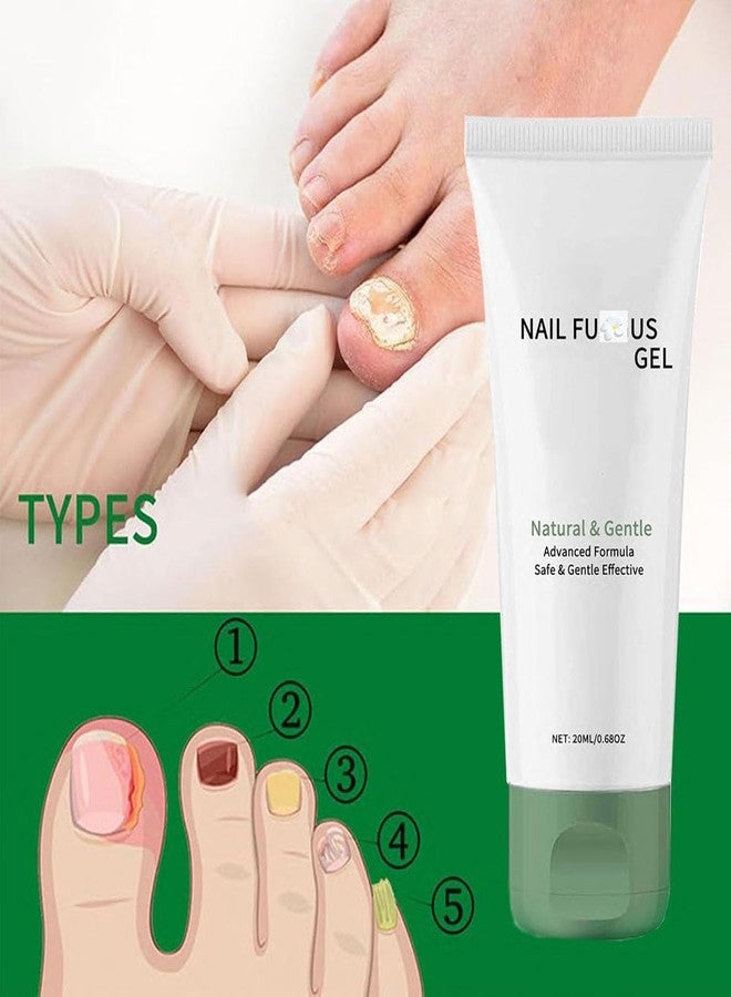 Lmoy 2PCS Nail Repair Gel, Nail Growth Repair Cream, Multi-Purpose Nail Repair - Image 4