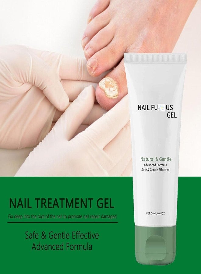 Lmoy 2PCS Nail Repair Gel, Nail Growth Repair Cream, Multi-Purpose Nail Repair - Image 5
