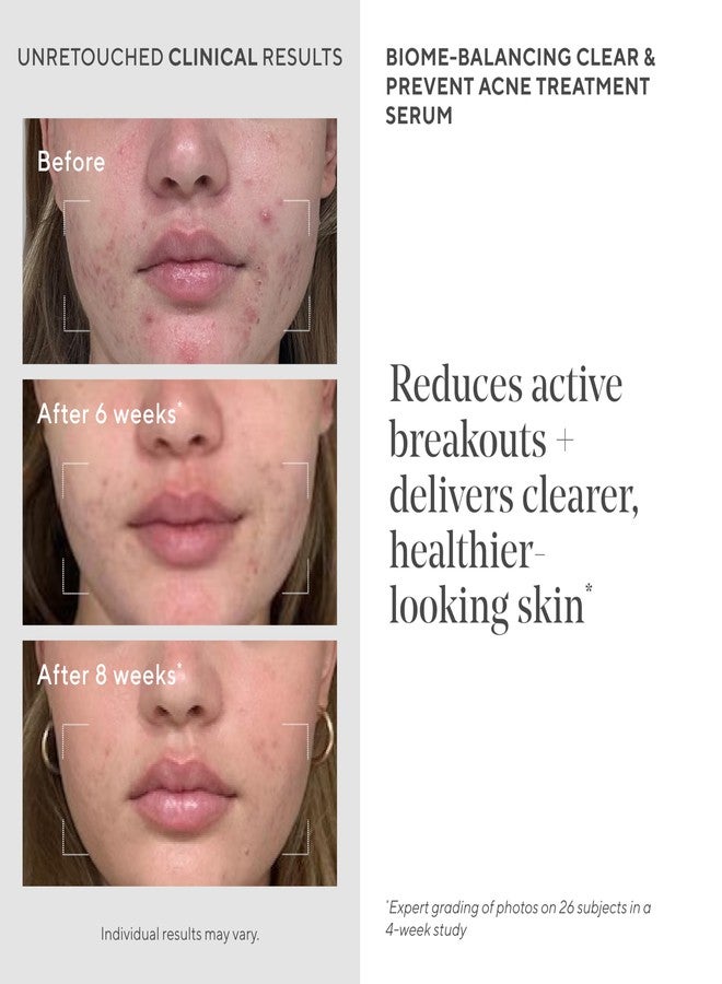 Murad Biome-Balancing Acne Treatment - Salicylic, Mandelic, and Glutamic Acid Serum for Clearing and Preventing Breakouts, Decongesting Pores, and Balancing Skin Microbiome - 1.0 Fl Oz - Image 4