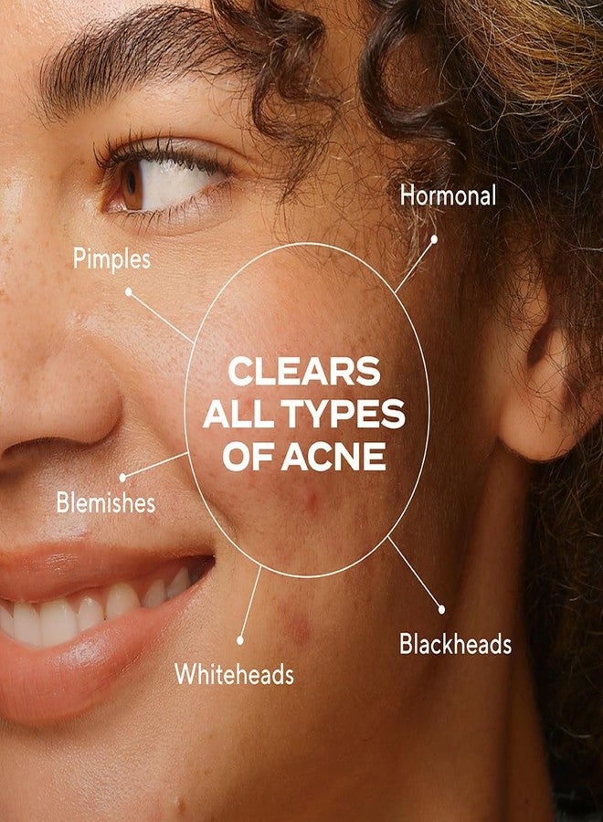 Murad Biome-Balancing Acne Treatment - Salicylic, Mandelic, and Glutamic Acid Serum for Clearing and Preventing Breakouts, Decongesting Pores, and Balancing Skin Microbiome - 1.0 Fl Oz - Image 2