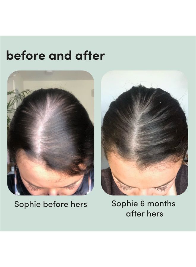 HIMS & HERS hers Triple Threat System Total Hair Package to Supports Hair Growth Minoxidil 2%, Shampoo, Conditioner, Biotin Hair Kit - 4pc - Image 2