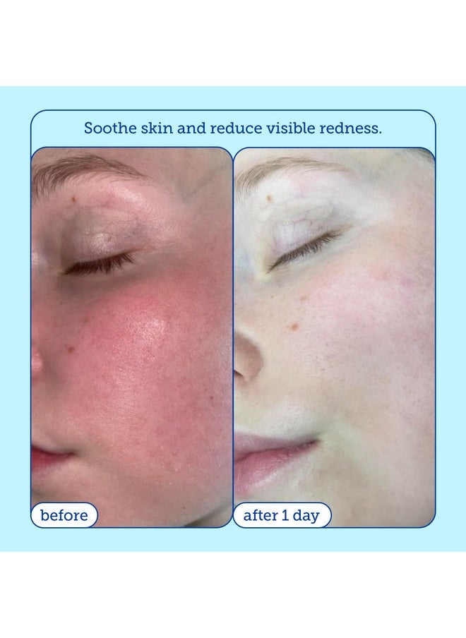 Skinfix - Barrier+ Foaming Oil Cleanser Gently Removes Dirt And Makeup Reduces Visible Redness Doesn’T Strip Skin Lipids 6 Fl Oz - Image 1