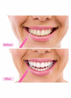 Excefore 100 Pieces Braces Brush for Cleaner Interdental Brush Toothpick Dental Tooth Flossing Head, Flosser Toothpick Cleaners Tooth Cleaning Tool (Bright Colors, Multiple Sizes)  - Image 4