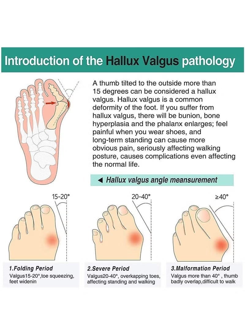 Gecomo 3 Pairs 2 Loops Toe Separators, Bunion Silicone Bunion Correctors, Toe Separators, Big Toe Space Suitable for Bunion and Overlap Toe (White) - Image 4