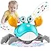 Gigilli Crawling Crab Baby Toys Tummy Time Baby Toys 61218 Month Infant Learning Crawl Walking Dancing Crab with MusicSpeed Control for 3 4 5 6 Boys Girls Year Easter Birthday 1 2 3 Gifts - Image 2