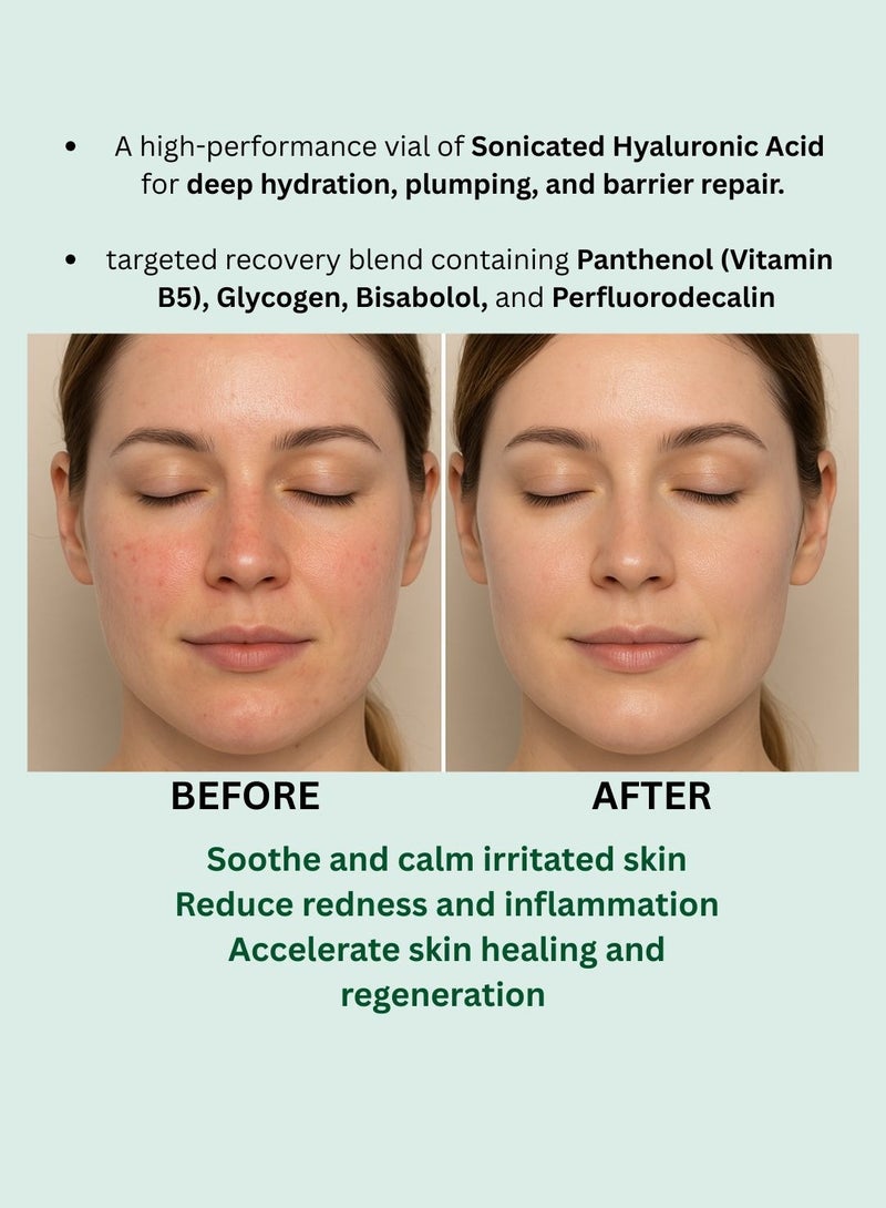 ®بونیتو ویتال اج ها - Image 3