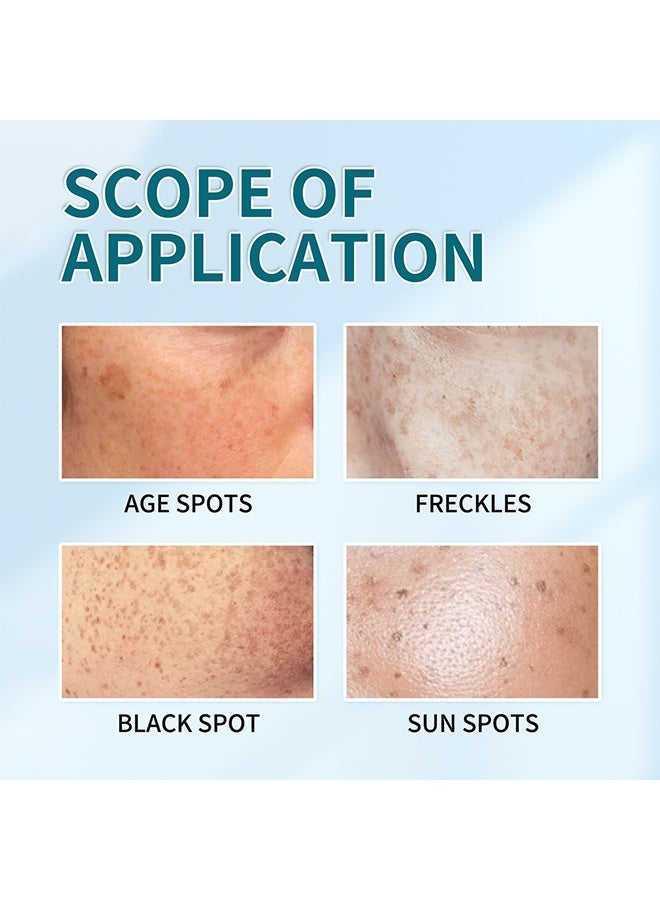 لونون كريم تفتيح البقع، مزيل البقع الداكنة لعلاج فرط التصبغ على الوجه، البقع الداكنة، الكلف، النمش، إزالة بقع الشمس، كريم تصحيح البقع الداكنة للنساء والرجال 20 جم - Image 4