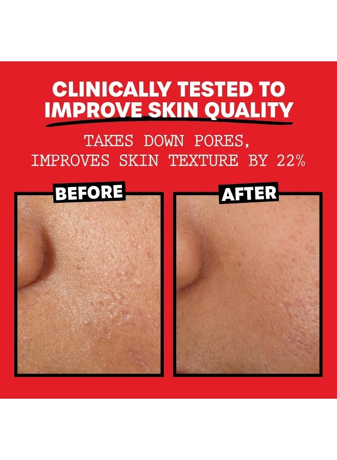 Thayers Witch Hazel With Rose Petal - 12 Fl Oz - 3 Pack - Image 5