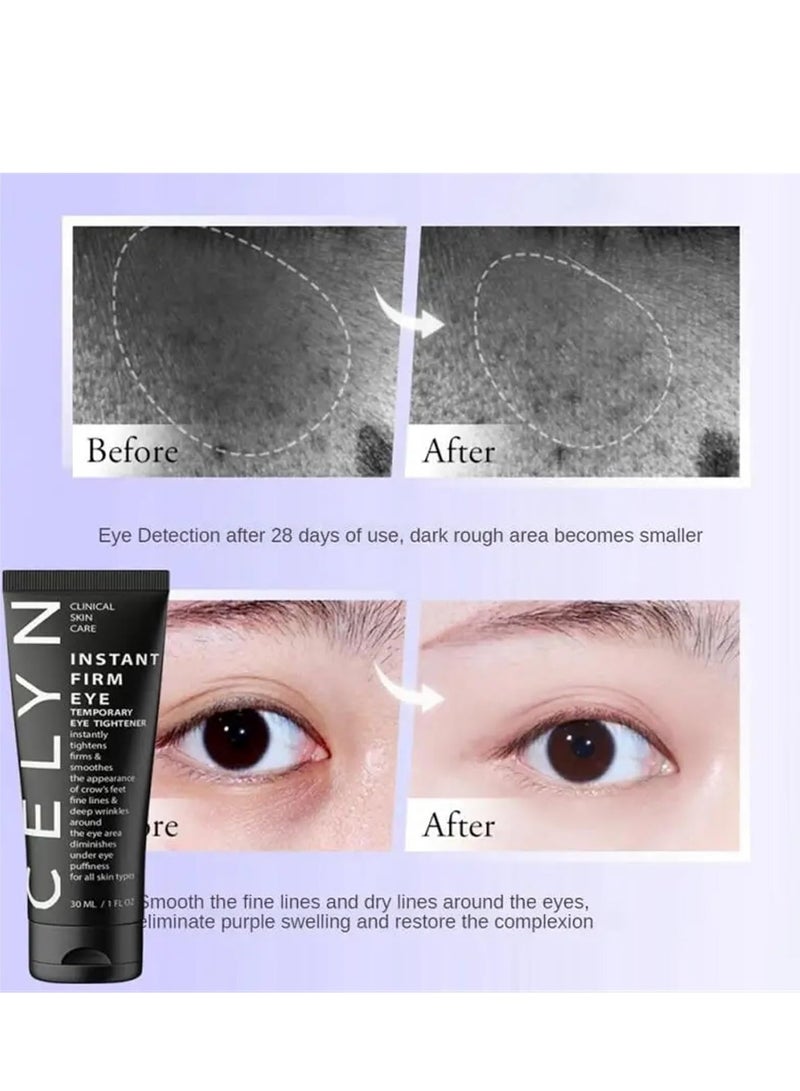 Celyn Wrinkle Eye Care Temporary Eye Bags Removal Eyes Cream Eye Cream Eye Firming Eye Lifting Firming Eye Bag Removal Dark Circles Temporary Eye Tightener Eye Cream Eye Cream for Puffiness and Bags U 30ml - Image 3