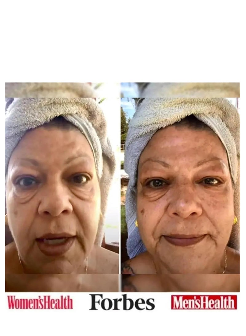 Celyn Wrinkle Eye Care Temporary Eye Bags Removal Eyes Cream Eye Cream Eye Firming Eye Lifting Firming Eye Bag Removal Dark Circles Temporary Eye Tightener Eye Cream Eye Cream for Puffiness and Bags U 30ml - Image 4